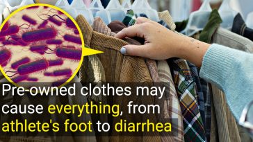 “They’re Swimming in Germs,” Scientists Give an Urgent Warning to Everyone Who Buys Vintage Second-Hand Clothes