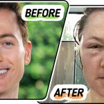 Anti-Aging Guru Bryan Johnson Shows How His Attempt to Turn Back the Clock Turned Into a Disaster