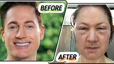 Anti-Aging Guru Bryan Johnson Shows How His Attempt to Turn Back the Clock Turned Into a Disaster