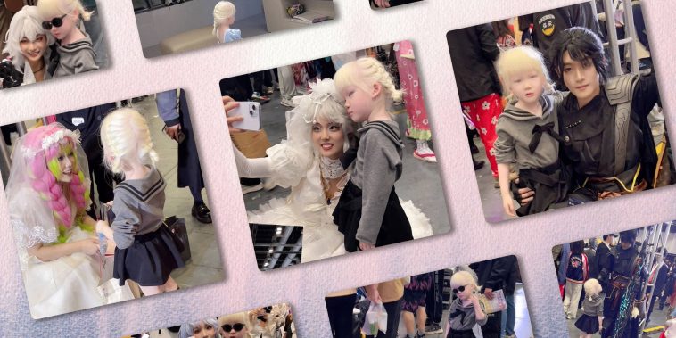 The Albino ‘Princess’ Growing Confidence in a Crowd