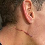 The huge cut on Michael McCarron’s face