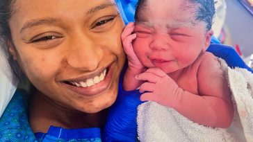 “You Must Be a Unique Being, Even Your Baby!” Mother Passes Rare Trait to Her Baby