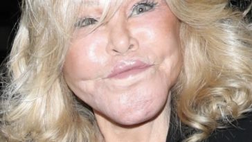 Jocelyne Wildenstein, ‘Catwoman’ Socialite Famous For Extreme Cosmetic Surgery, Passes Away At 84