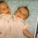 Conjoined Twins Who Paid Double College Fees Now Earn One Salary, Sparking Debate