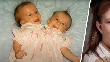 Conjoined Twins Who Paid Double College Fees Now Earn One Salary, Sparking Debate