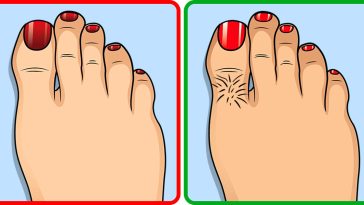 9 Health Signs Your Feet Might Reveal About Your Body