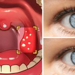 12 Ways Your Body May Be Telling You That You Have Gluten Sensitivity