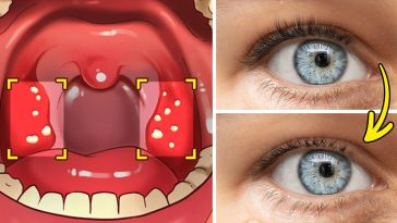 12 Ways Your Body May Be Telling You That You Have Gluten Sensitivity