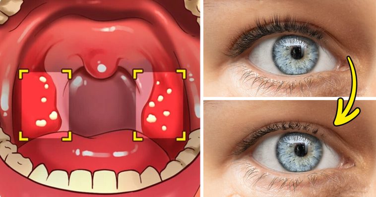 12 Ways Your Body May Be Telling You That You Have Gluten Sensitivity