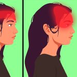 Doctor Warns About a Common Headache That May Affect People Over 50 as Migraines Decline