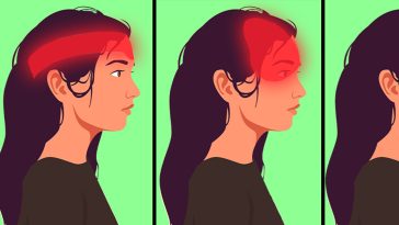 Doctor Warns About a Common Headache That May Affect People Over 50 as Migraines Decline