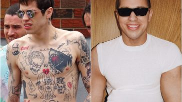Pete Davidson’s Post-Tattoo-Removal Photos Will Blow Your Mind
