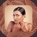 Zap Pimples Fast With These 7 Acne Spot Treatments That Actually Work