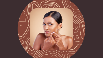 Zap Pimples Fast With These 7 Acne Spot Treatments That Actually Work