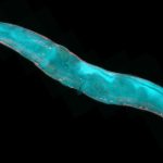 Love or immortality: A short story