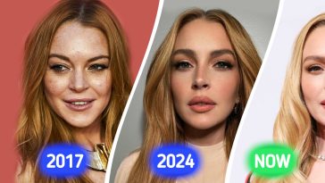 Lindsay Lohan Shocks the Internet Again With New Look, Plastic Surgeon Reveals What She Could Have Done