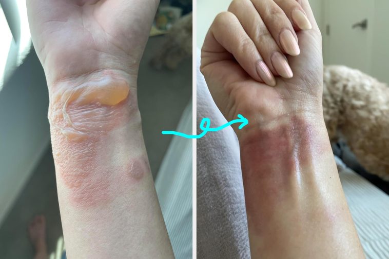 17 Personal Care Products With Before And After Photos So Gnarly, You Probably Shouldn’t Look If You’re Squeamish