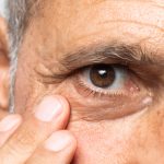 Glaucoma: SUS amplia exames; acesso desigual preocupa especialistas