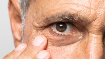 Glaucoma: SUS amplia exames; acesso desigual preocupa especialistas