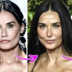 Experts Explain the Mystery of What Might Have Happened to Demi Moore’s Face