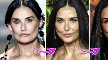 Experts Explain the Mystery of What Might Have Happened to Demi Moore’s Face