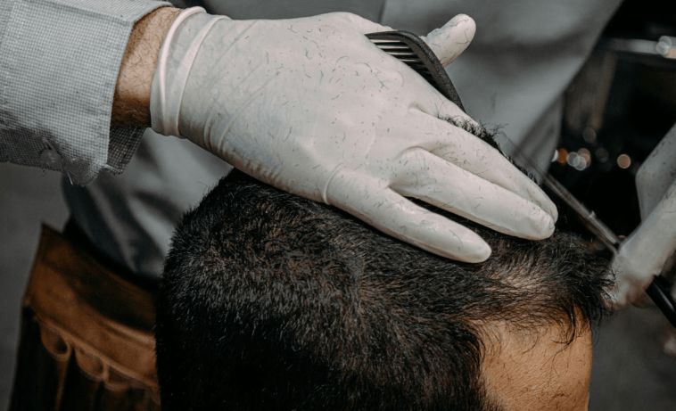 The Secret to Affordable Celebrity Hair: How Much Is a Top-End Hair Transplant in Turkey?