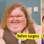 “Proud of You,” 1000-lb Sisters Star’s Incredible Before and After Skin Removal Surgery