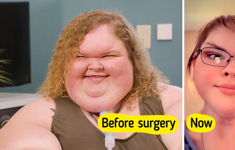 “Proud of You,” 1000-lb Sisters Star’s Incredible Before and After Skin Removal Surgery
