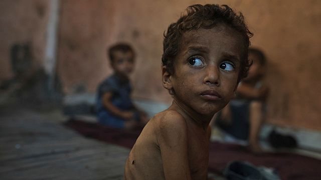 ‘From bad to worse’: Gaza hospital faces surge in child hunger deaths