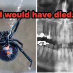 “A Little Voice Told Me To Be Careful” — People Are Sharing The Dumbest Ways They Almost Died, And Some Of These Are Terrifying But Some Are Hilarious