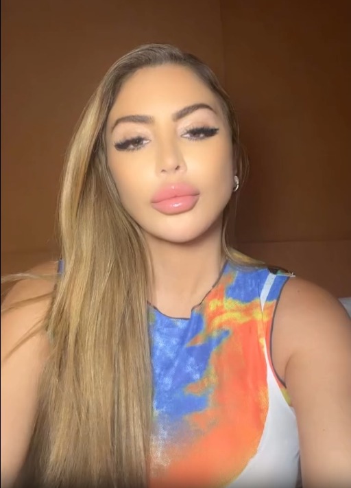 Larsa Pippen doubles down on allergic reaction claims after photo of ‘overfilled’ face went viral: ‘Keep on hating’