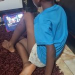 “Early care saved my son from severe mpox disease”