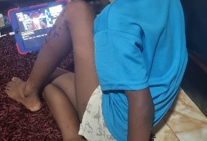 “Early care saved my son from severe mpox disease”