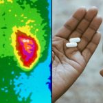 Grim consequences man suffered after taking 1,176 ibuprofen tablets in a month