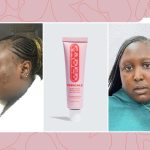 Why I’m Adding Topicals Faded to My Skincare Routine After A Month