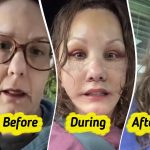 Woman, 50, Reveals Major Plastic Surgery Results That Make Her Look Decades Younger