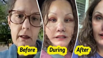 Woman, 50, Reveals Major Plastic Surgery Results That Make Her Look Decades Younger