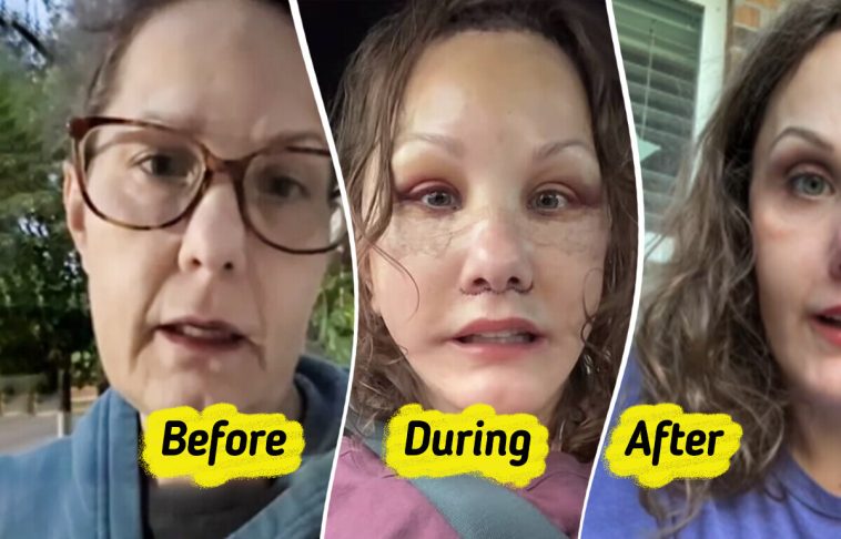 Woman, 50, Reveals Major Plastic Surgery Results That Make Her Look Decades Younger