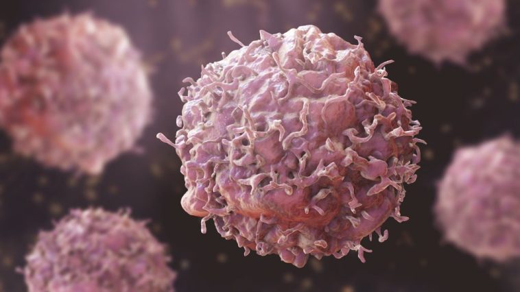 Global cancer toll to rise by 61% in 2050 – Report