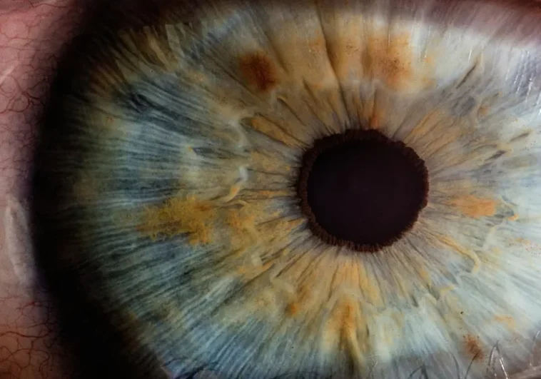 A rice-sized bionic eye implant could bring artificial vision into the real world