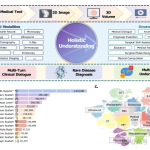 One Model for All Medical Data: Hulu-Med Explores a New Open-Source Paradigm for Medical Foundation Models | Zhejiang University × SJTU × UIUC