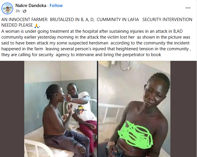 Suspected herdsmen chop off woman’s hand in Nasarawa community